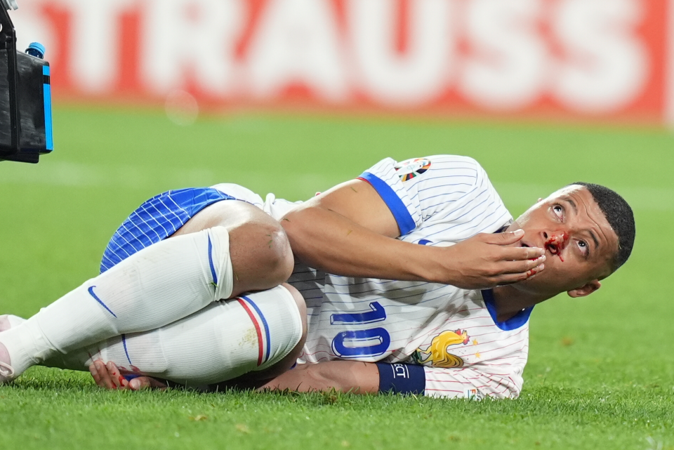 Kylian Mbappe victime d’une fracture du nez lors d’un match Euro 2024